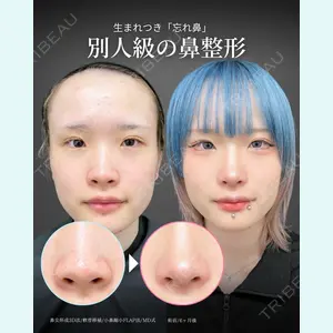 東京シンデレラ美容外科 新宿院 吉原 伯医師の症例