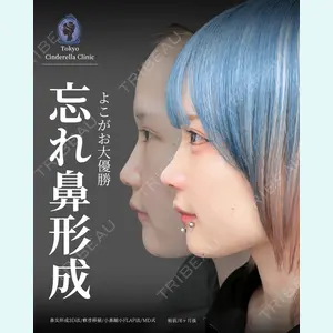 東京シンデレラ美容外科 新宿院 吉原 伯医師の症例