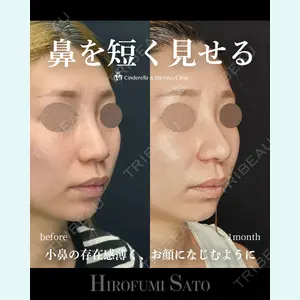 症例