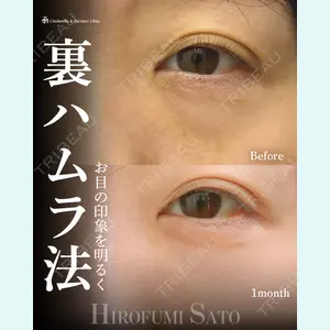 症例