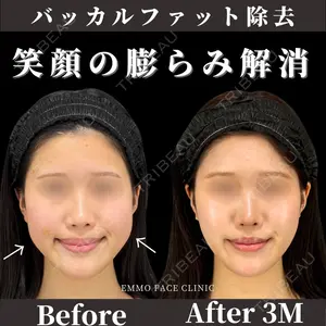 症例