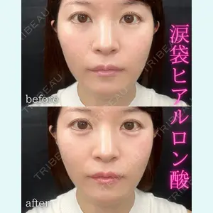 症例