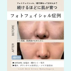 LiLAスキンクリニック中目黒の症例
