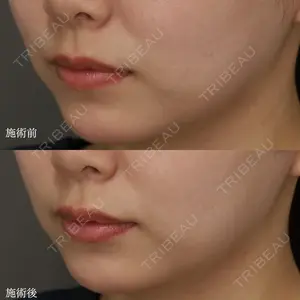Jスキンクリニック 【J-SKIN clinic】 牧野　潤医師の症例