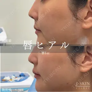 Jスキンクリニック 【J-SKIN clinic】 牧野　潤医師の症例