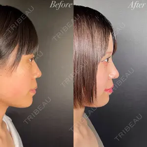 R Beauty CLINIC 銀座院 吉田　慧医師の症例
