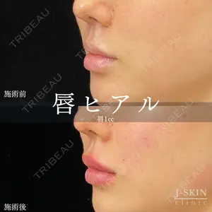 Jスキンクリニック 【J-SKIN clinic】 牧野　潤医師の症例