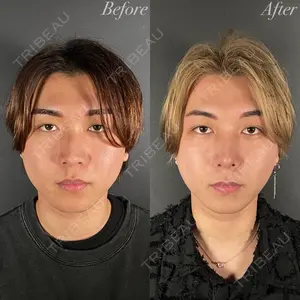 症例