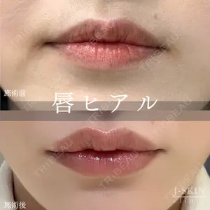 Jスキンクリニック 【J-SKIN clinic】 牧野　潤医師の症例