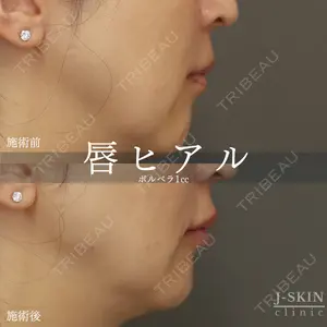 Jスキンクリニック 【J-SKIN clinic】 牧野　潤医師の症例