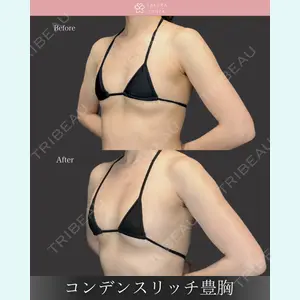 さくらバストクリニック 富田 さくら医師の症例