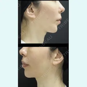 下北沢スキンクリニック 保坂 宗孝医師の症例
