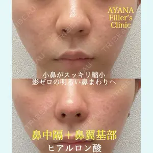 症例