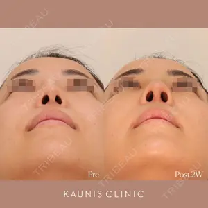 KAUNIS CLINIC（カウニスクリニック） 高野 敏郎医師の症例