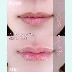 症例