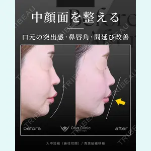 症例