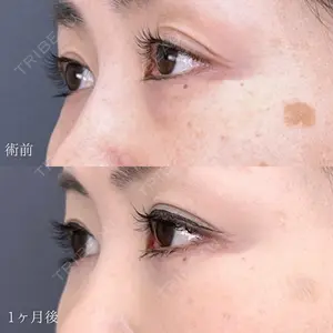 TCB東京中央美容外科 福山院 大隈 宏通医師の症例