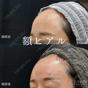 Jスキンクリニック 【J-SKIN clinic】の症例