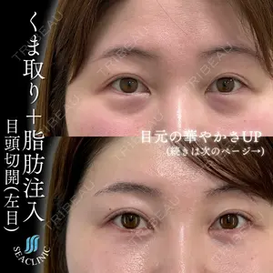 症例