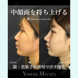 シンデレラ＆ダヴィンチクリニック 宮田 洋佑医師の症例