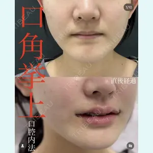 症例