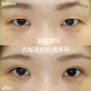 大塚美容形成外科 札幌院の症例