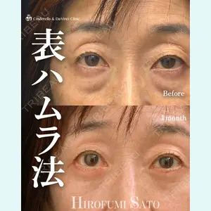 症例