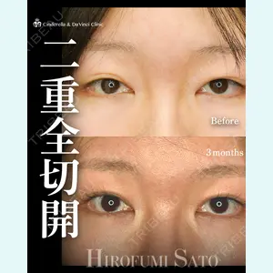 症例