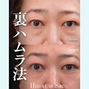 症例