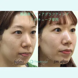 症例