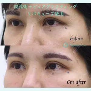 症例