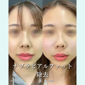 ルラ美容クリニック 渋谷本院 住友 沙織医師の症例