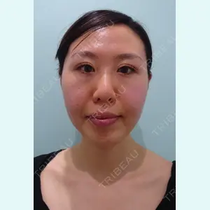 WOM CLINIC GINZA （ワム クリニック ギンザ） 深堀 純也医師の症例