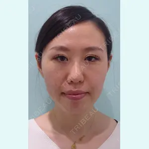 WOM CLINIC GINZA （ワム クリニック ギンザ） 深堀 純也医師の症例