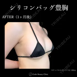 Code Beauty Clinic 名古屋院 橋本 祥平医師の症例