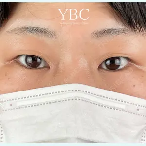 YBC横浜美容外科 大宮院 磯村 亮輔医師の症例