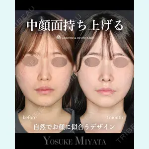 シンデレラ＆ダヴィンチクリニック 宮田 洋佑医師の症例