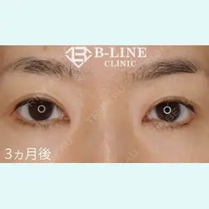 B-LINE CLINIC 池袋院 小池 康弘医師の症例