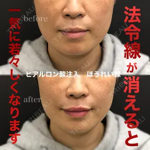 ロレシー美容クリニック 心斎橋駅前院 福留院長医師の症例