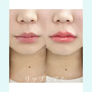 ルラ美容クリニック 郡山院 横瀬 晃平医師の症例