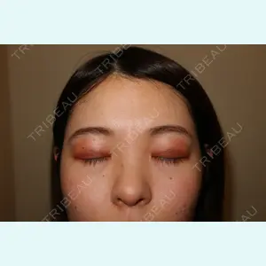 麹町皮ふ科・形成外科クリニックの症例