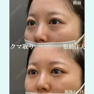お茶の水美容形成クリニック 吉井 健吾医師の症例