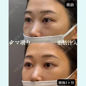 お茶の水美容形成クリニック 吉井 健吾医師の症例