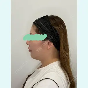 Olivia Clinic 山﨑 香名医師の症例