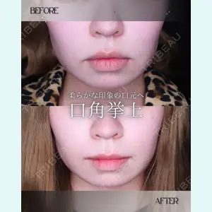 小倉美容外科/美容皮膚科 ビラビューティークリニック 大村 亞蘭医師の症例