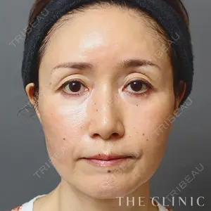 THE CLINIC（ザ・クリニック）東京院 加藤 敏次医師の症例