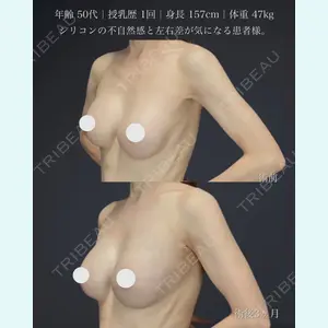 さくらバストクリニック 富田 さくら医師の症例