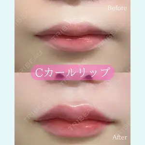 ルラ美容クリニック 郡山院 横瀬 晃平医師の症例