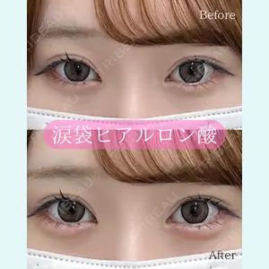 ルラ美容クリニック 郡山院 横瀬 晃平医師の症例