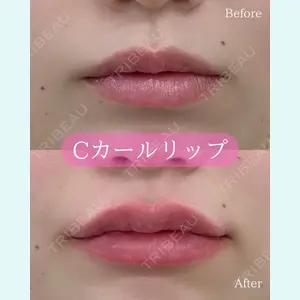 ルラ美容クリニック 郡山院 横瀬 晃平医師の症例